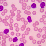 Immune cells in the healthy mouth