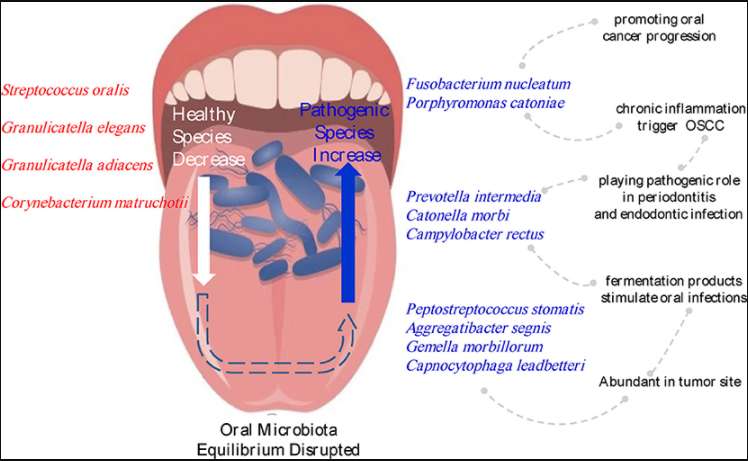 Changes in the microbiota composition associated with OSCC