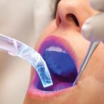 Autofluorescence and its use in the early detection of oral cancer
